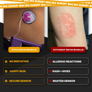 Skin Defender By Skin Grip - Infusion Sets