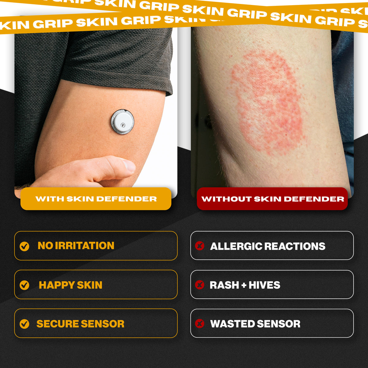 Skin Defender By Skin Grip - Freestyle Libre 3