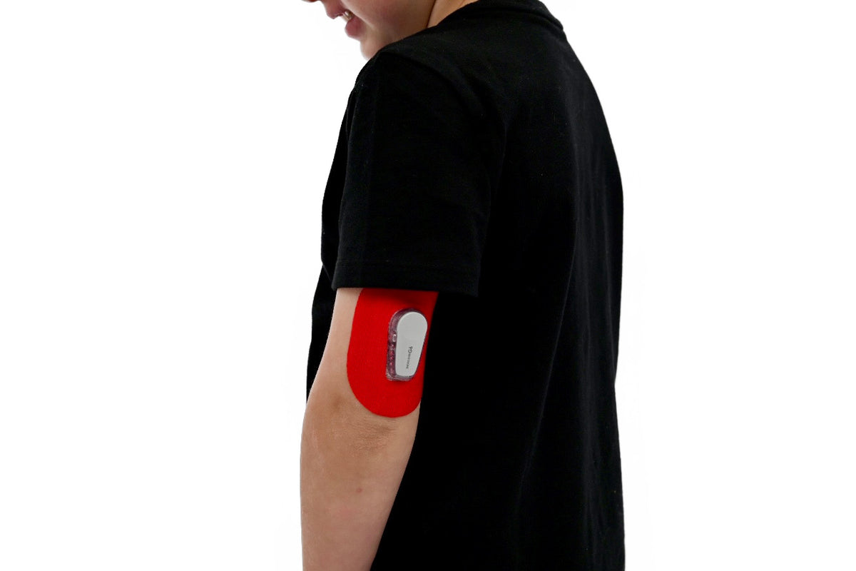 Skin Grip Kids - Mini Dexcom G6/One Patch - 20 Pack