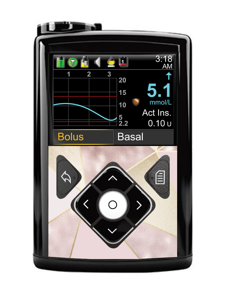 Medtronic 640G/670G/780G Button Panel Sticker (Blush Geo)
