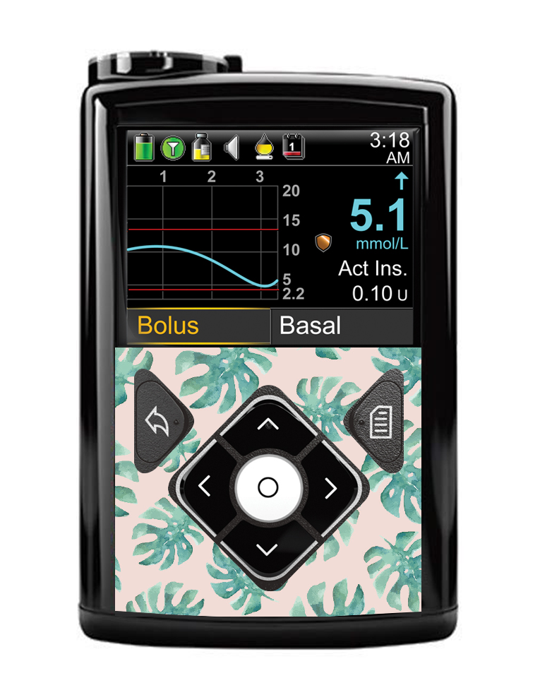 A Medtronic pump sticker with a tropical leaf pattern applied to the front panel.