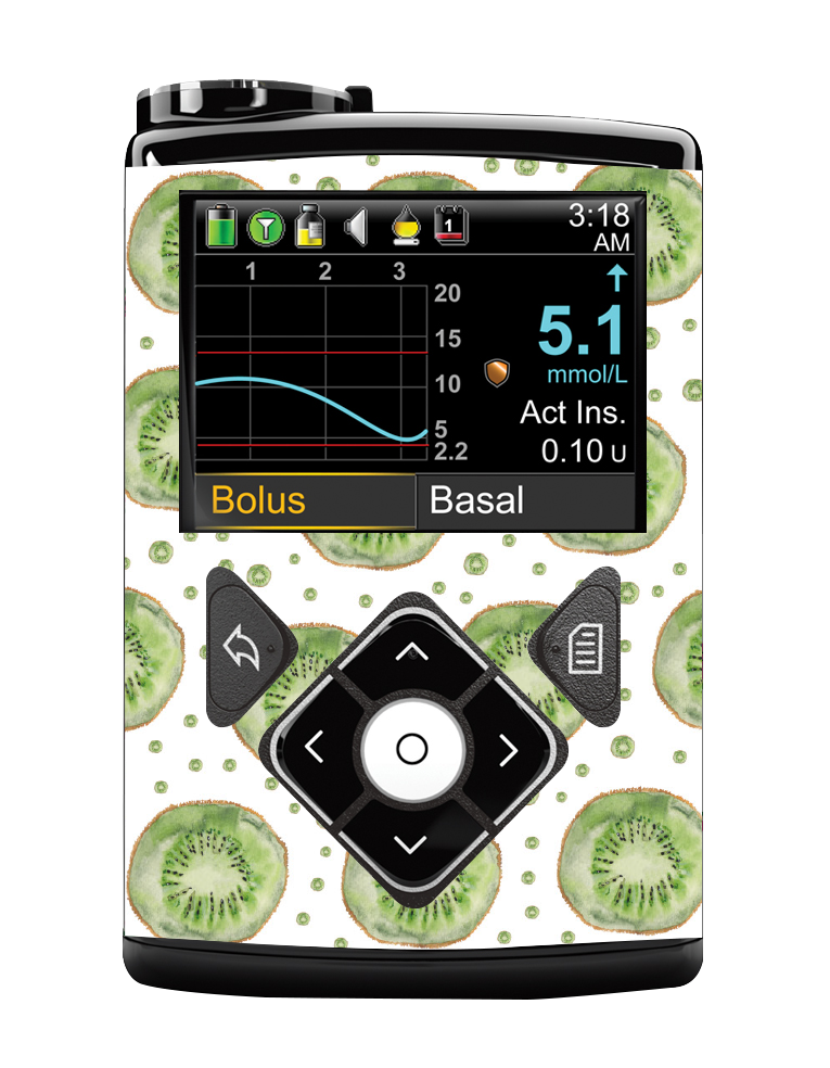 Medtronic 640/670/780G Pump Sticker (Kiwi Life)