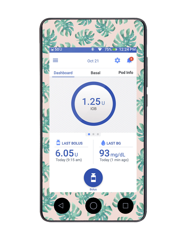 Omnipod DASH Cover (Tropical Vibes)