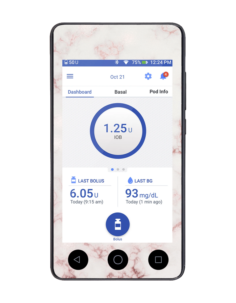 Omnipod DASH Cover (Marble Dreams)